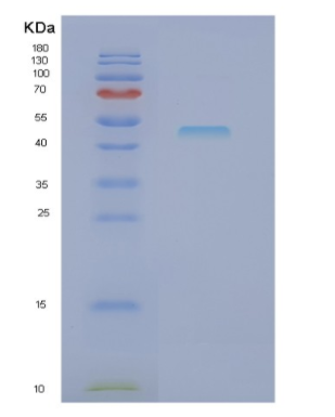 Recombinant Human NCK1 Protein,Recombinant Human NCK1 Protein