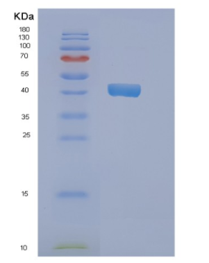 Recombinant Human NDRG2 Protein,Recombinant Human NDRG2 Protein