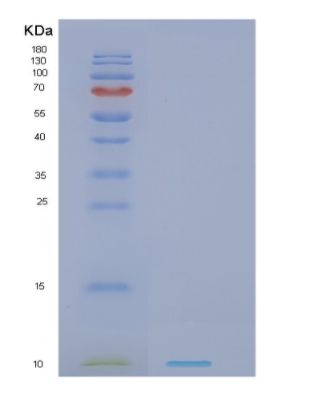 Recombinant Human NDUFV3 Protein,Recombinant Human NDUFV3 Protein