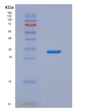 Recombinant Human NIT2 Protein,Recombinant Human NIT2 Protein