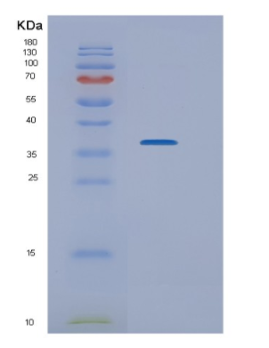 Recombinant Human NEK7 Protein,Recombinant Human NEK7 Protein