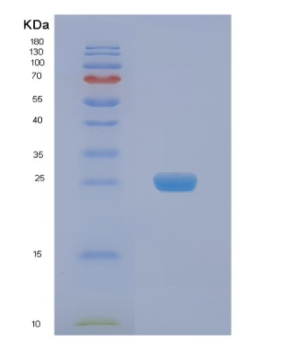 Recombinant Human NAA50 Protein,Recombinant Human NAA50 Protein