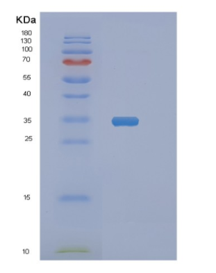 Recombinant Human NANOGP8 Protein,Recombinant Human NANOGP8 Protein