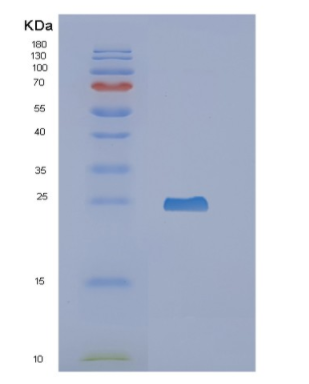 Recombinant Human NCALD Protein,Recombinant Human NCALD Protein