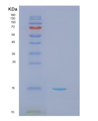 Recombinant Human NCR2 Protein,Recombinant Human NCR2 Protein