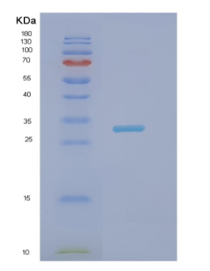 Recombinant Human NECAP2 Protein,Recombinant Human NECAP2 Protein