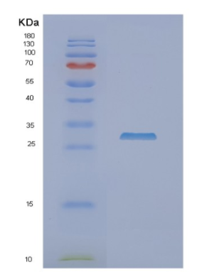 Recombinant Human NFU1 Protein,Recombinant Human NFU1 Protein
