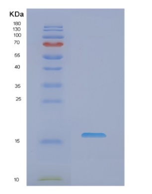 Recombinant Human NME2 Protein,Recombinant Human NME2 Protein