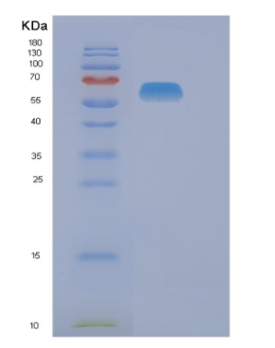 Recombinant Human NAE1 Protein,Recombinant Human NAE1 Protein