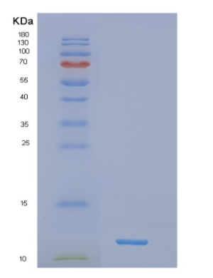 Recombinant Human NDUFB4 Protein,Recombinant Human NDUFB4 Protein