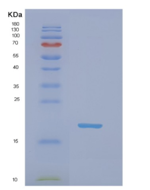 Recombinant Rat Nme2 Protein,Recombinant Rat Nme2 Protein