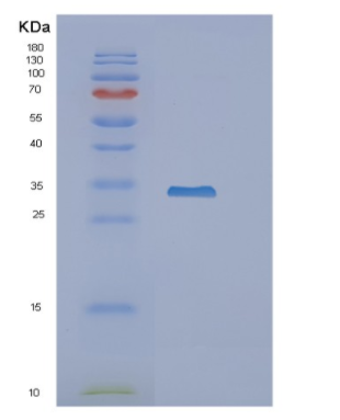 Recombinant Mouse Nnmt Protein,Recombinant Mouse Nnmt Protein