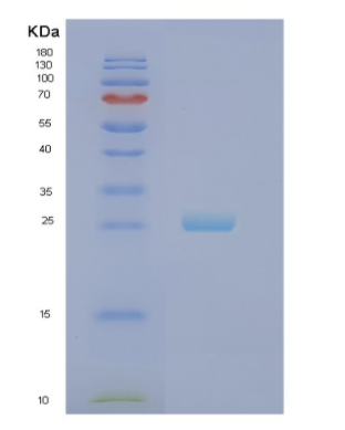 Recombinant Human NOL3 Protein,Recombinant Human NOL3 Protein