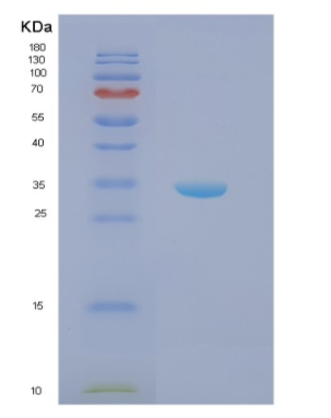 Recombinant Human NPM1 Protein,Recombinant Human NPM1 Protein