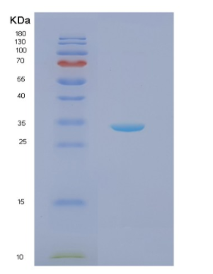 Recombinant Human NQO1 Protein,Recombinant Human NQO1 Protein