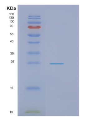 Recombinant Human NRK1 Protein,Recombinant Human NRK1 Protein