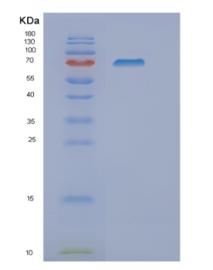 Recombinant Human NT5C2 Protein,Recombinant Human NT5C2 Protein