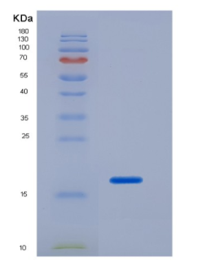 Recombinant Neurotrophin 4 (NT4),Recombinant Neurotrophin 4 (NT4)