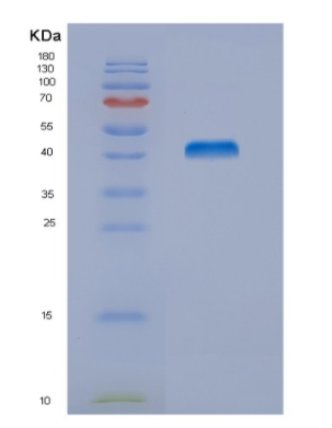 Recombinant Mouse Nucb2 Protein,Recombinant Mouse Nucb2 Protein