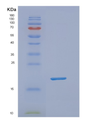 Recombinant Human NUDT1 Protein,Recombinant Human NUDT1 Protein