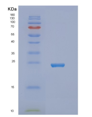 Recombinant Human NUDT16 Protein,Recombinant Human NUDT16 Protein