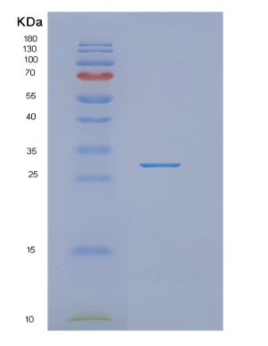 Recombinant Human NUDT21 Protein,Recombinant Human NUDT21 Protein