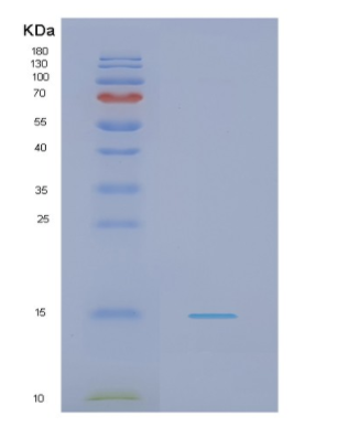 Recombinant Human NDUFS5 Protein,Recombinant Human NDUFS5 Protein