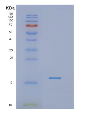 Recombinant Human NHLH1 Protein,Recombinant Human NHLH1 Protein