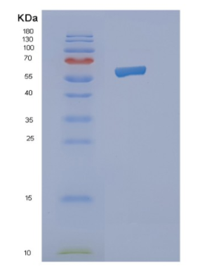 Recombinant Human NMT2 Protein,Recombinant Human NMT2 Protein