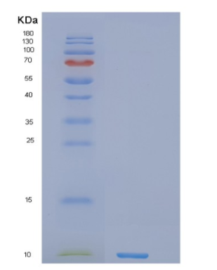 Recombinant Human NREP Protein,Recombinant Human NREP Protein