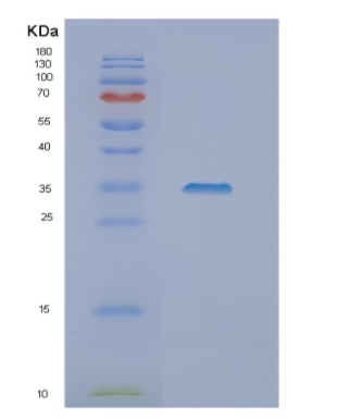 Recombinant Human NSL1 Protein,Recombinant Human NSL1 Protein