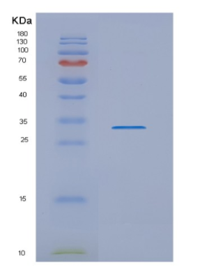 Recombinant Human NUBP2 Protein,Recombinant Human NUBP2 Protein