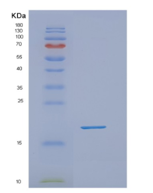 Recombinant Human NUDT10 Protein,Recombinant Human NUDT10 Protein