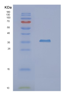 Recombinant Human NUDT9 Protein,Recombinant Human NUDT9 Protein