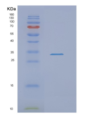 Recombinant Human NSMCE1 Protein,Recombinant Human NSMCE1 Protein