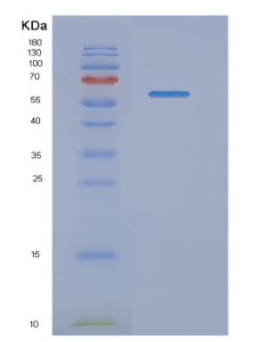 Recombinant Human NMT1 Protein,Recombinant Human NMT1 Protein