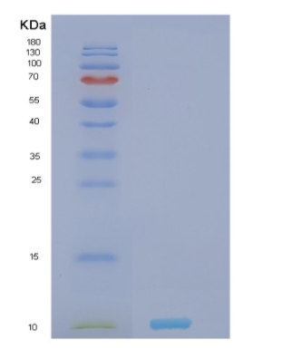 Recombinant Human NRGN Protein,Recombinant Human NRGN Protein