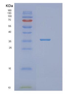 Recombinant Human NTHL1 Protein,Recombinant Human NTHL1 Protein