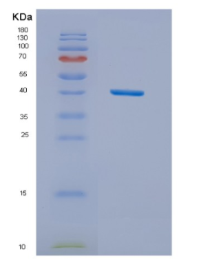 Recombinant Human NUDC Protein,Recombinant Human NUDC Protein