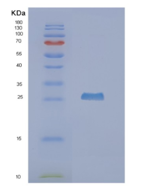 Recombinant Human NUDT5 Protein,Recombinant Human NUDT5 Protein