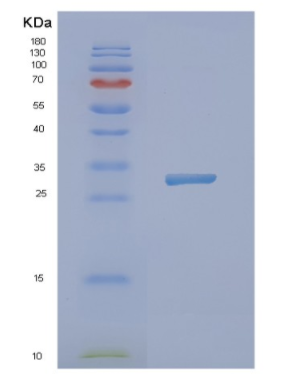 Recombinant Human NXPH1 Protein,Recombinant Human NXPH1 Protein