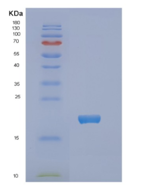 Recombinant E.coli NDK Protein,Recombinant E.coli NDK Protein