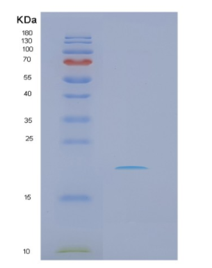 Recombinant Human NRAS Protein,Recombinant Human NRAS Protein