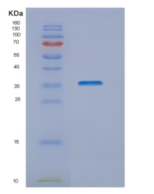 Recombinant Human NUBP1 Protein,Recombinant Human NUBP1 Protein