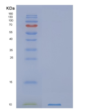 Recombinant Human NUP62CL Protein,Recombinant Human NUP62CL Protein