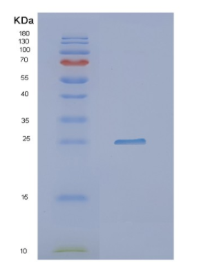 Recombinant Human NXT2 Protein,Recombinant Human NXT2 Protein