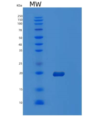 Recombinant Human OCIAD2 Protein,Recombinant Human OCIAD2 Protein