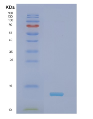 Recombinant Human NDUFS6 Protein,Recombinant Human NDUFS6 Protein