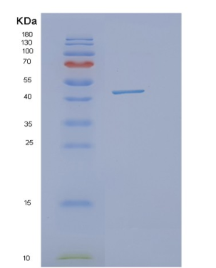 Recombinant Human OBFC1 Protein,Recombinant Human OBFC1 Protein