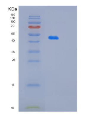 Recombinant Human OLA1 Protein,Recombinant Human OLA1 Protein